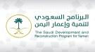 جهود البرنامج السعودي لإعمار اليمن تسهم بتحسين الخدمات في اليمن ...