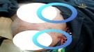 قناص حوثي يستهدف امرأة بعيار ناري شمال الضالع ...